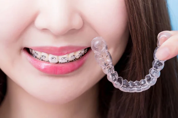 blog_the_role_of_lasers_in_modern_orthodontics1
