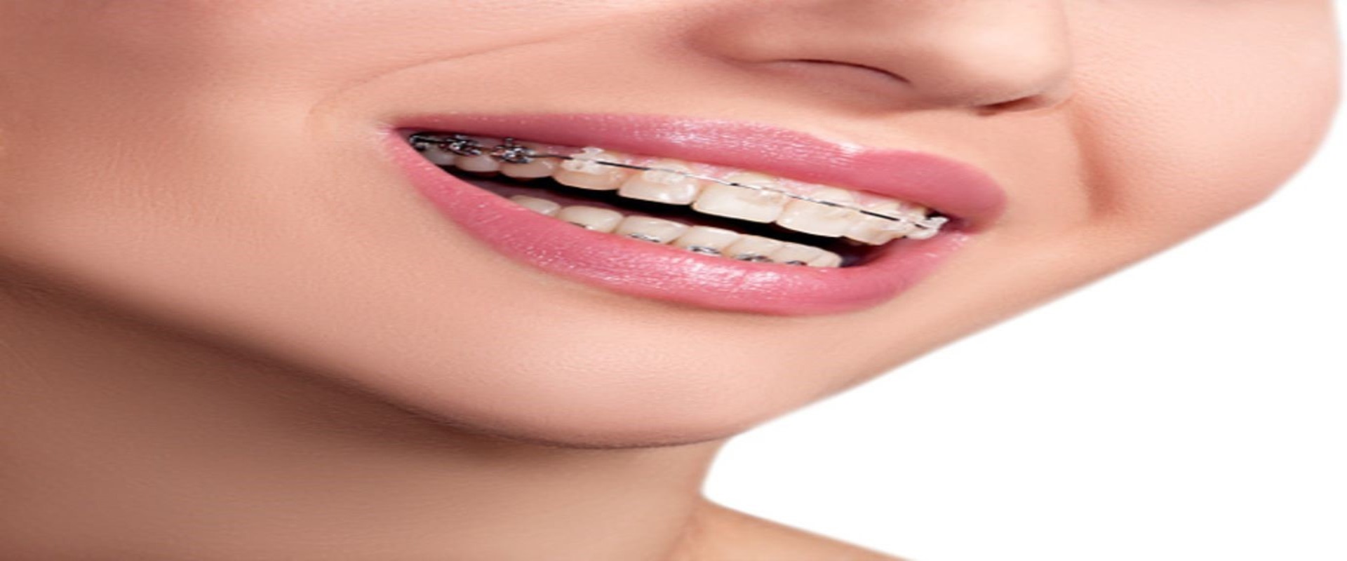 blog_the_role_of_lasers_in_modern_orthodontics2