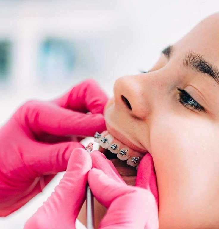 Free_Orthodontic