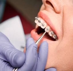 orthodontics1