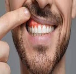 periodontics3