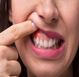 periodontics4